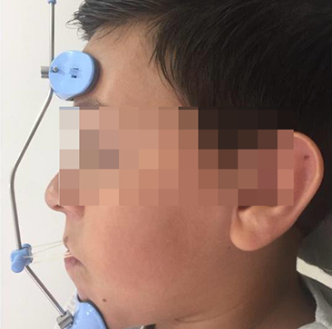 Colocar tarja antes de postar ou usar 1